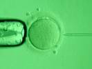 : http://www.baby-ivf.ru/i/ixi1.jpg